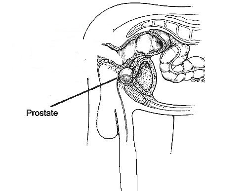 Простата Простата