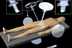 Радиоактивное излучение при раке простаты Радиоактивное излучение при раке простаты
