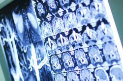 Детальное изображение мягких тканей