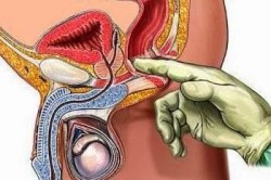 Ректальное исследование простаты Ректальное исследование простаты