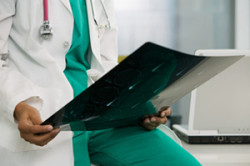 Рентген копчика для выявления причин опухоли Рентген копчика для выявления причин опухоли