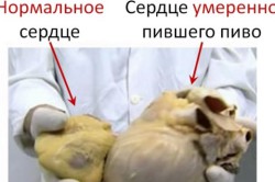 Влияние пива на сердце Влияние пива на сердце