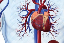 Заболевание сердечно сосудистой системы Заболевание сердечно сосудистой системы