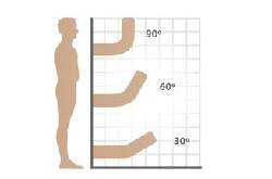 Угол отклонения пениса Угол отклонения пениса