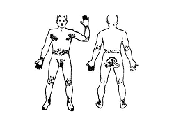 Излюбленные места обитания чесоточного клеща Излюбленные места обитания чесоточного клеща