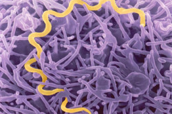 Лечение сифилиса медицинскими препаратами Лечение сифилиса медицинскими препаратами