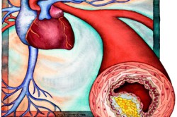 Сосуды Сосуды