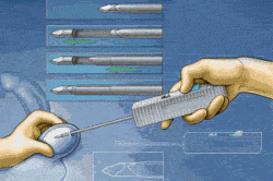 Обструктивная азооспермия Обструктивная азооспермия