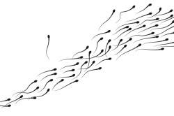 Спермограмма Спермограмма