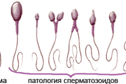 Морфологический анализ сперматозоидов Морфологический анализ сперматозоидов