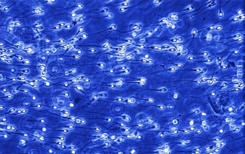 Сперма представляет собой вязкую жидкость серовато-белого оттенка Сперма представляет собой вязкую жидкость серовато-белого оттенка