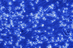 Улучшение спермограммы Улучшение спермограммы