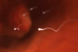 Мертвые сперматазоиды Мертвые сперматазоиды