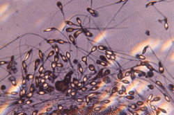 Сперматозоиды Сперматозоиды