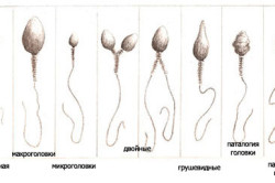 Виды сперматазоидов Виды сперматазоидов