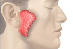 Опухание желез Опухание желез