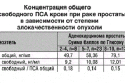 Таблица концентрации ПСА Таблица концентрации ПСА