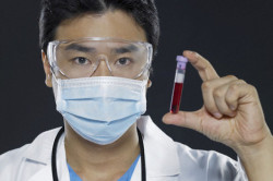 Анализ на тестостерон