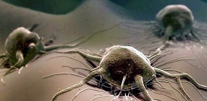 Опасный паразит - трихомонада Опасный паразит - трихомонада