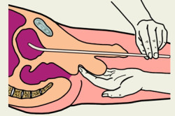 Мазок с уреты Мазок с уреты