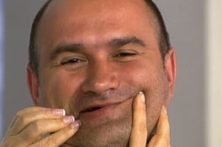 Улыбка при микроинсульте Улыбка при микроинсульте