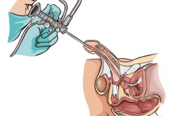 УЗИ и уретроскопия УЗИ и уретроскопия