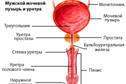Уретрит - воспаление уретры Уретрит - воспаление уретры