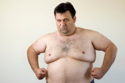 Мужчина с увеличенными молочными железами Мужчина с увеличенными молочными железами