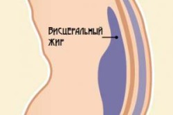 Расположение висцерального жира