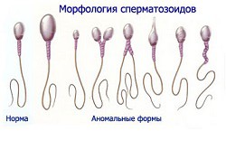 Морфология сперматозоидов Морфология сперматозоидов