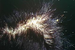 Алопеция себорейная Алопеция себорейная