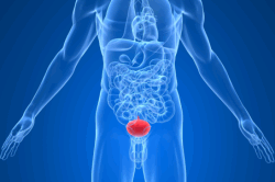 Воспаление мочеполовой системы Воспаление мочеполовой системы