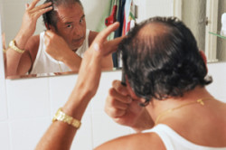 Залысина на макушке у мужчины