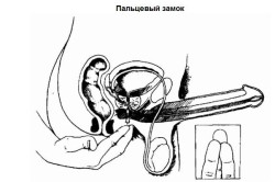 Сдерживание семяизвержения Сдерживание семяизвержения
