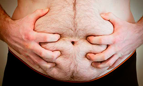 Лишний вес при баланопостите Лишний вес при баланопостите